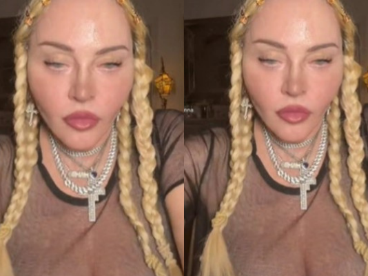 Woman tattoos "baby hairs" across her forehead