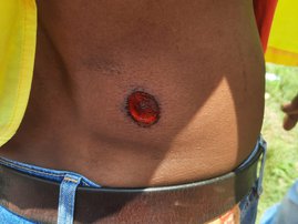 Saccawu worker injured 1
