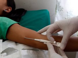 Subdermal Implanon contraceptive