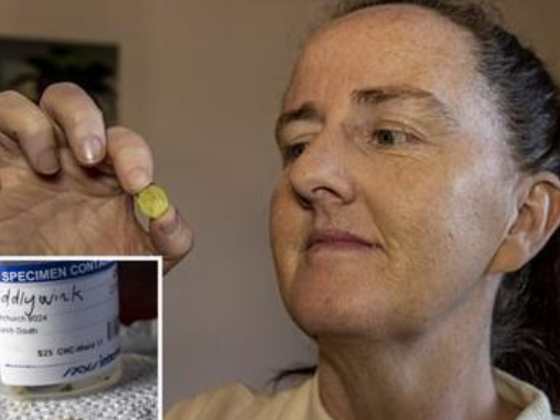 A woman goes for a COVID test and finds a toy in her nose after 37 years
