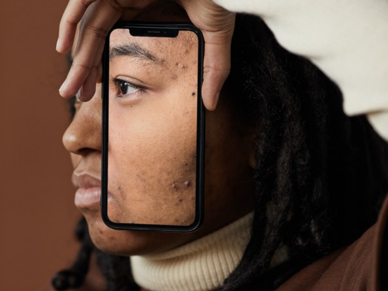 Woman in white sweater holding transparent cellphone case on face