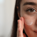 Young woman with dry skin applying cream onto her face