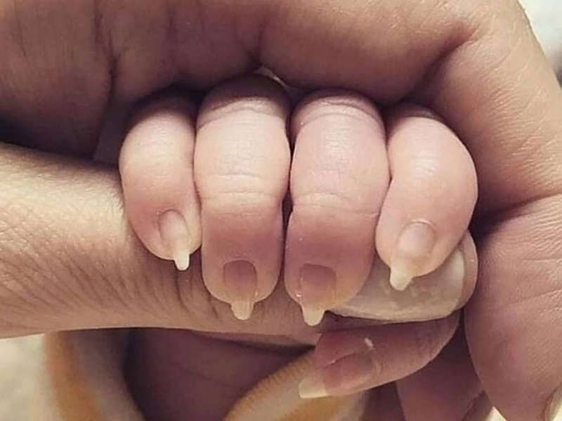 Baby nails