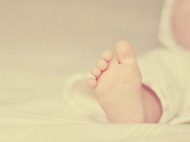 baby born with 31 fingers & toes
