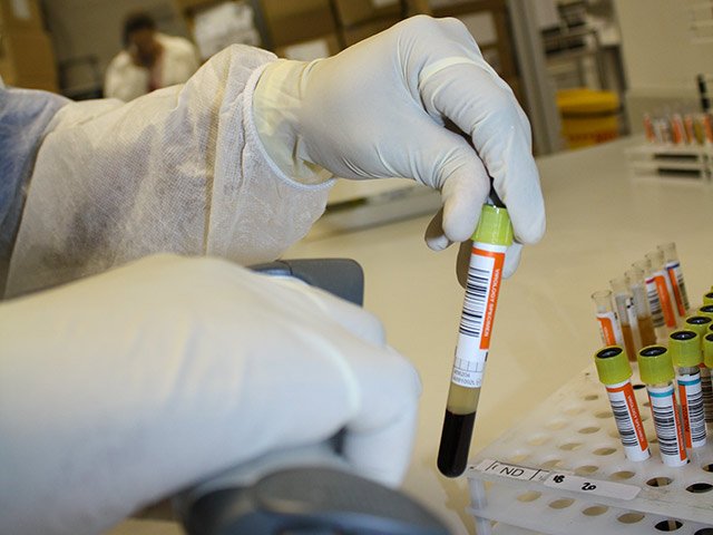 blood_donation_testing_2_sanbs_8KkWpKn.jpg