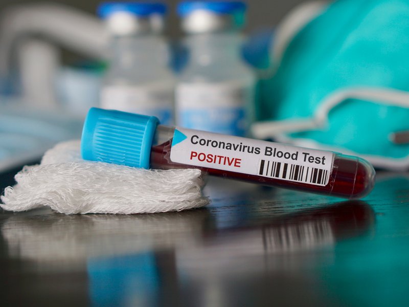 Coronavirus blood test