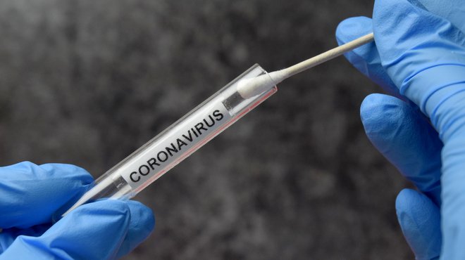 Coronavirus test