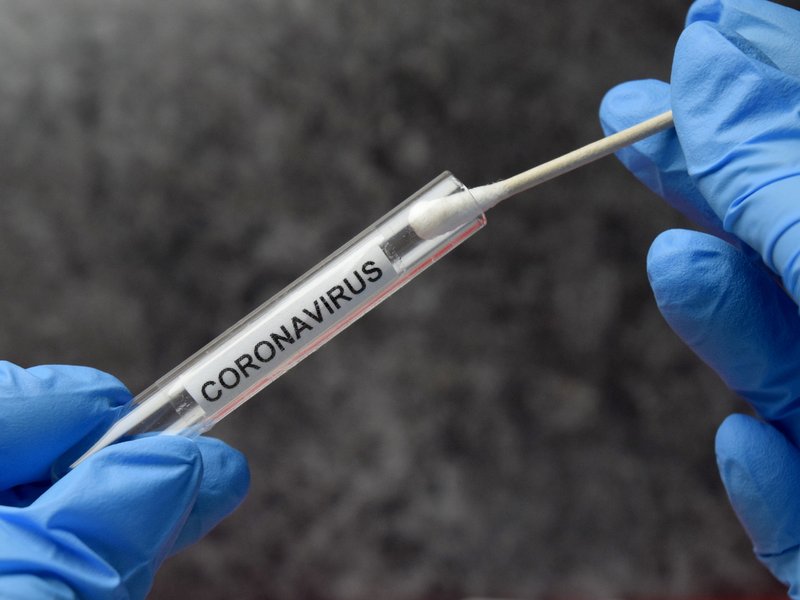 Coronavirus test