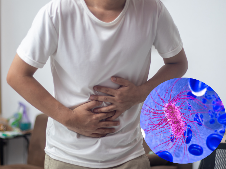 E. coli infection