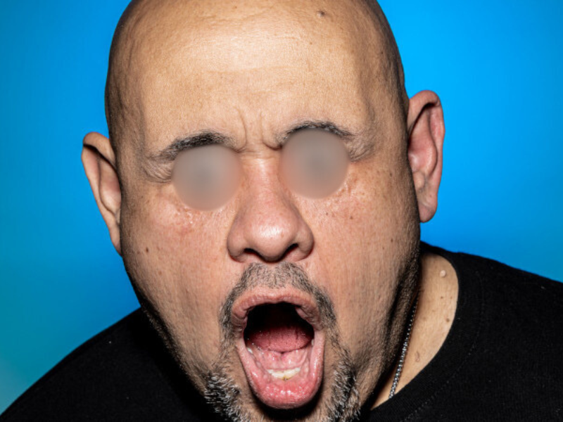 WATCH: Man sets jaw-dropping record for farthest eye pop!