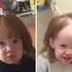 A little girl removes hair with hair removal
