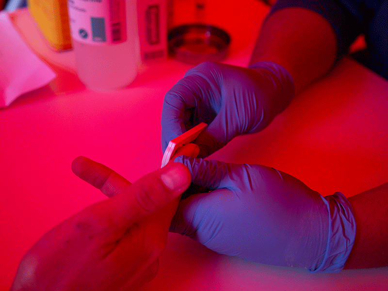 HIV test