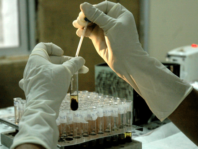 HIV testing, blood tests