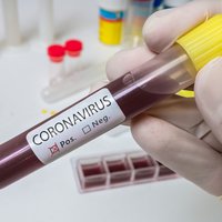 covid-19 coronavirus test positive