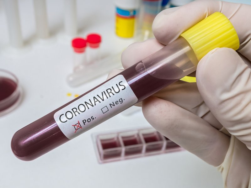 covid-19 coronavirus test positive