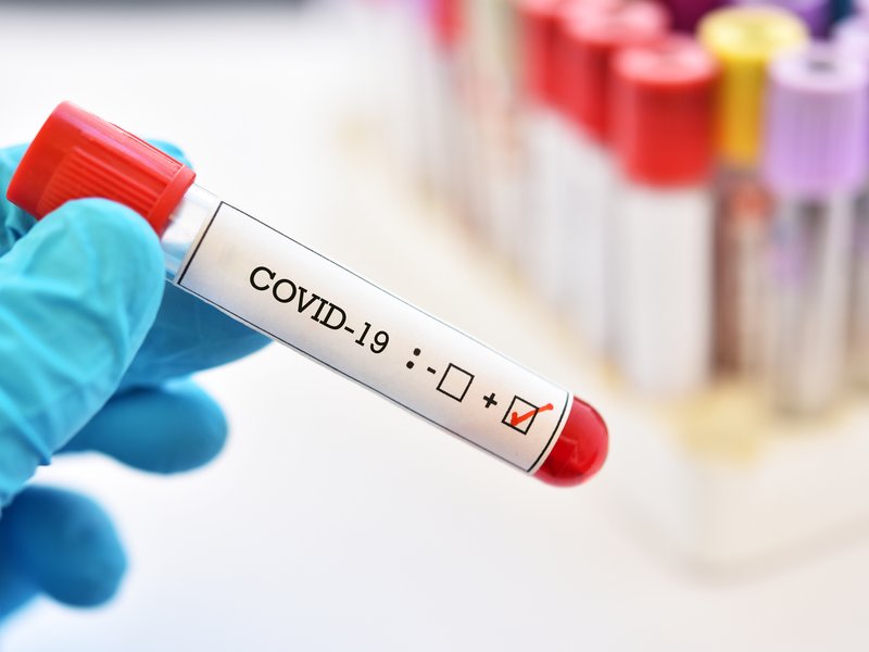 coronavirus positive generic