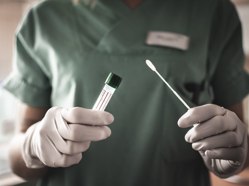 Nurse holds a swab for the coronavirus / covid19 test stock photo