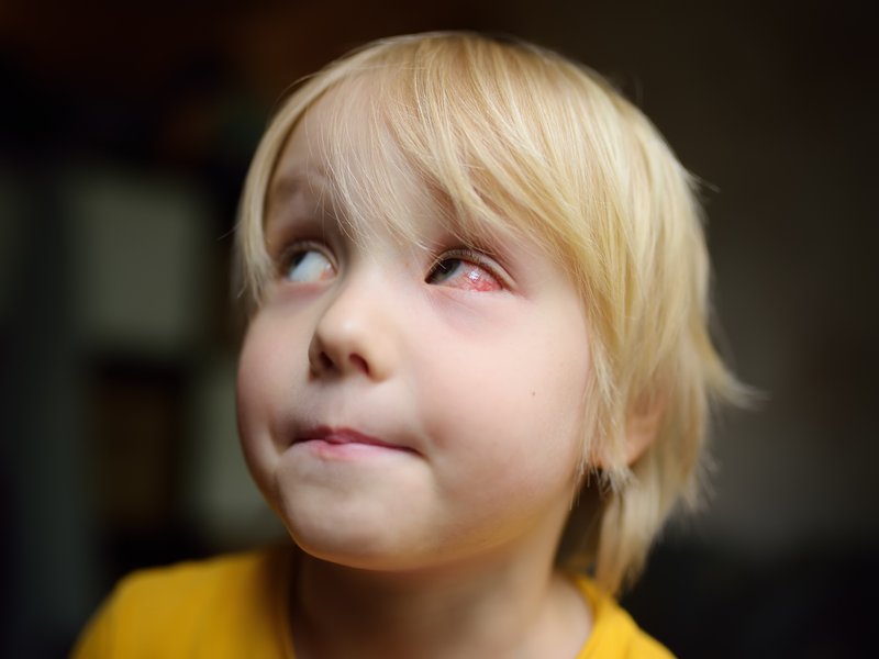 56,000 Pakistan schools shut over eye virus outbreak