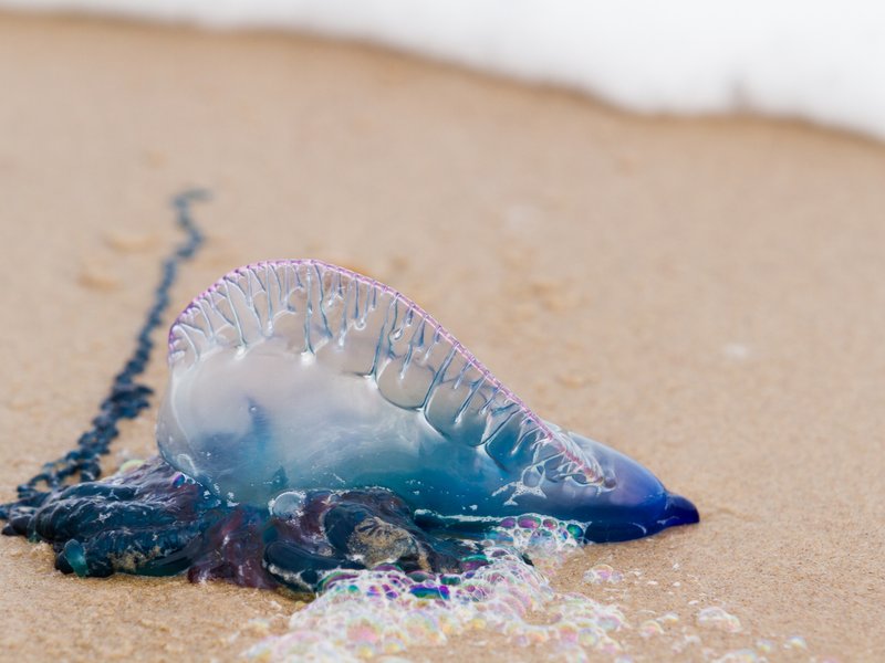 Bluebottle sting
