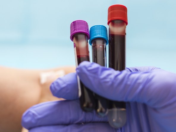 Researchers develop artificial blood to assist shortages