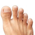 Hairy toes health
