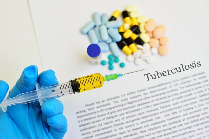 MSF welcomes withdrawal of patents on life-saving TB drug in SA