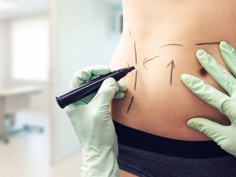 plastic surgeon