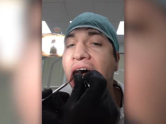 image dentist extracting tooth
