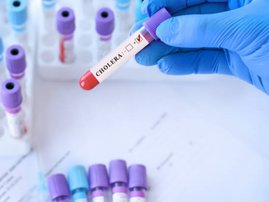 Cholera test