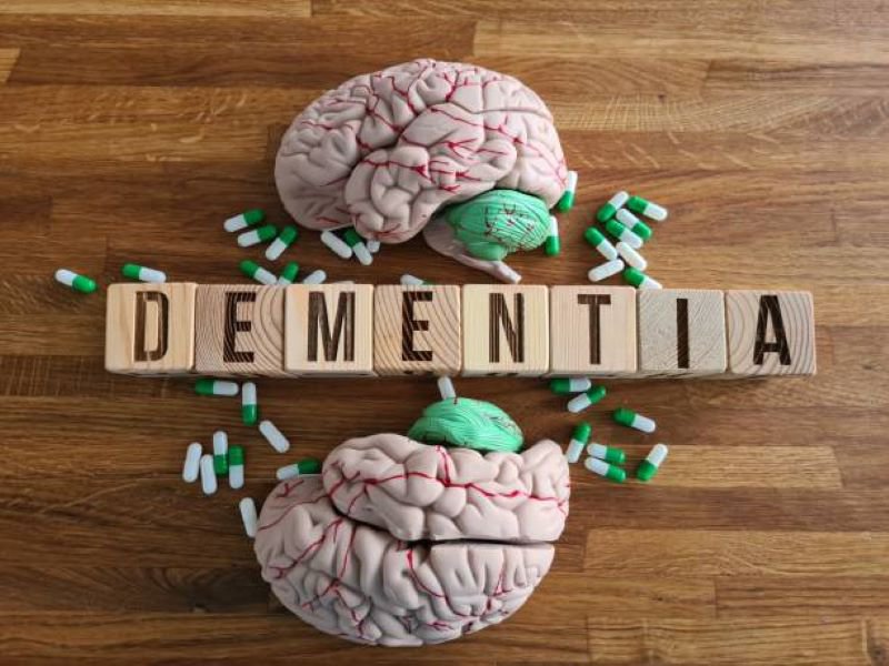 Dementia generic stock image