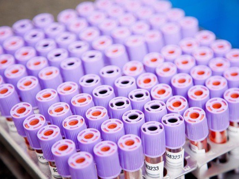 lab samples