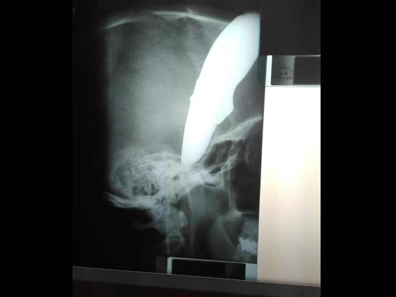 shaun wayne xray