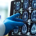Surgical globe pointing at brain scan