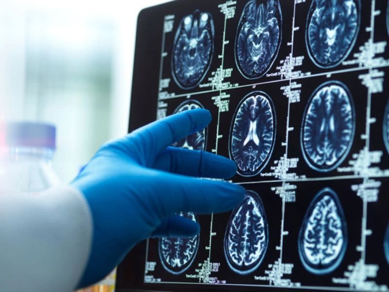 Surgical globe pointing at brain scan