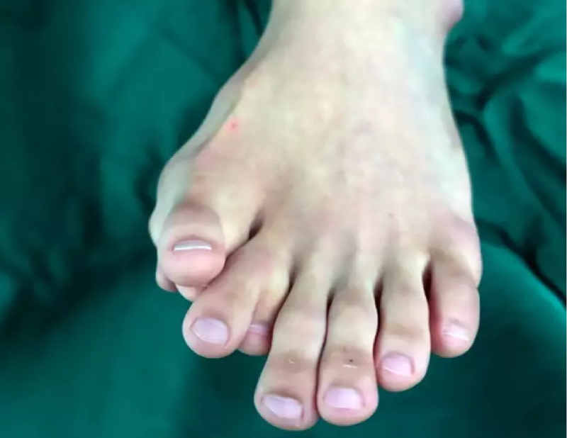 toes