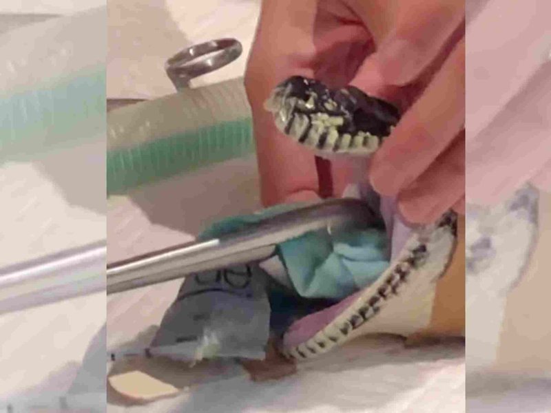 WATCH: Snake gulps beach towel gets treatment