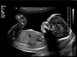 ultrasound.jpg