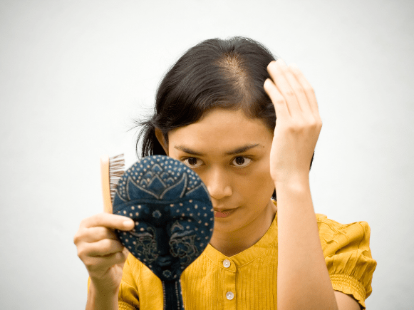 Woman hair loss