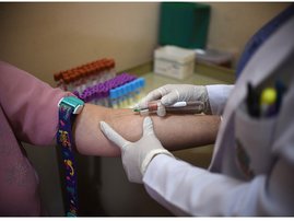 Zika virus